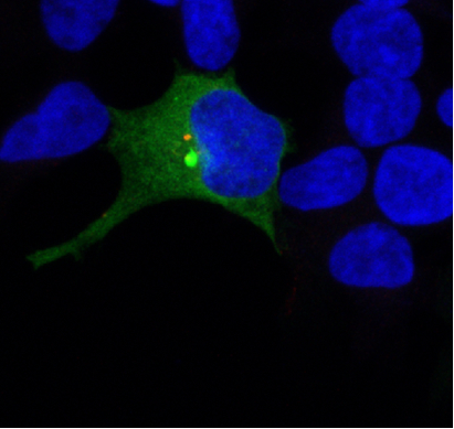 33E – Estudio molecular y celular del Parkinson hereditario